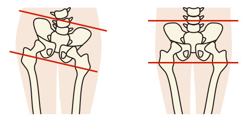 腰痛の原因とは？